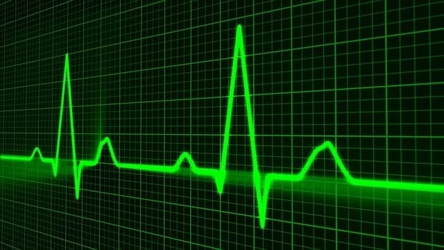 pulse survey software - pulse demonstration